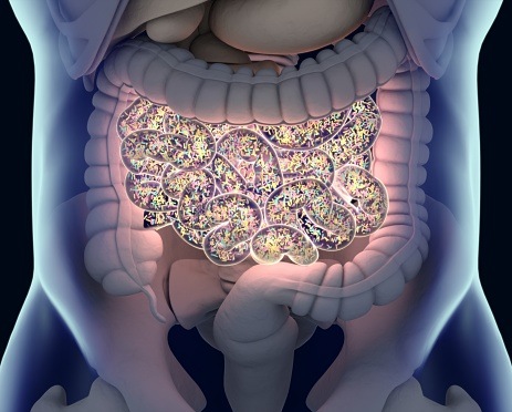 Survival Examined for Early-Onset Colorectal Cancer