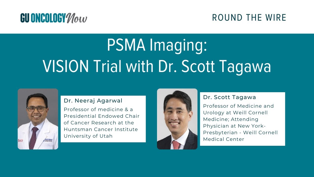 PSMA Imaging: VISION Trial With Dr. Scott Tagawa